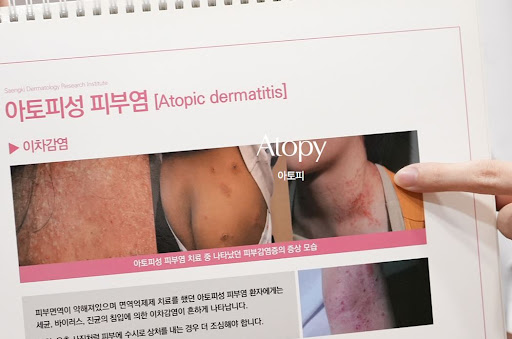 생기한의원이 설명하는 아토피 찰상과 피부 손상 확인 방법